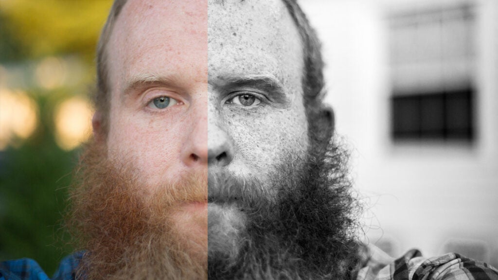 Emphasizing Freckles in Adobe Photoshop and Lightroom