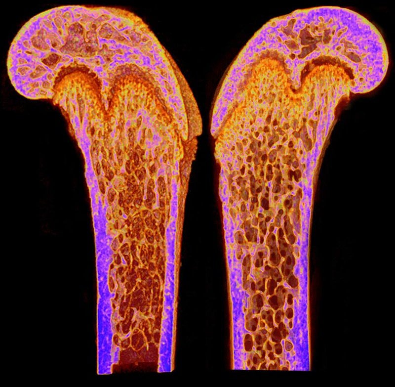 A CT scan depicts the density of the femurs of two young mice.
