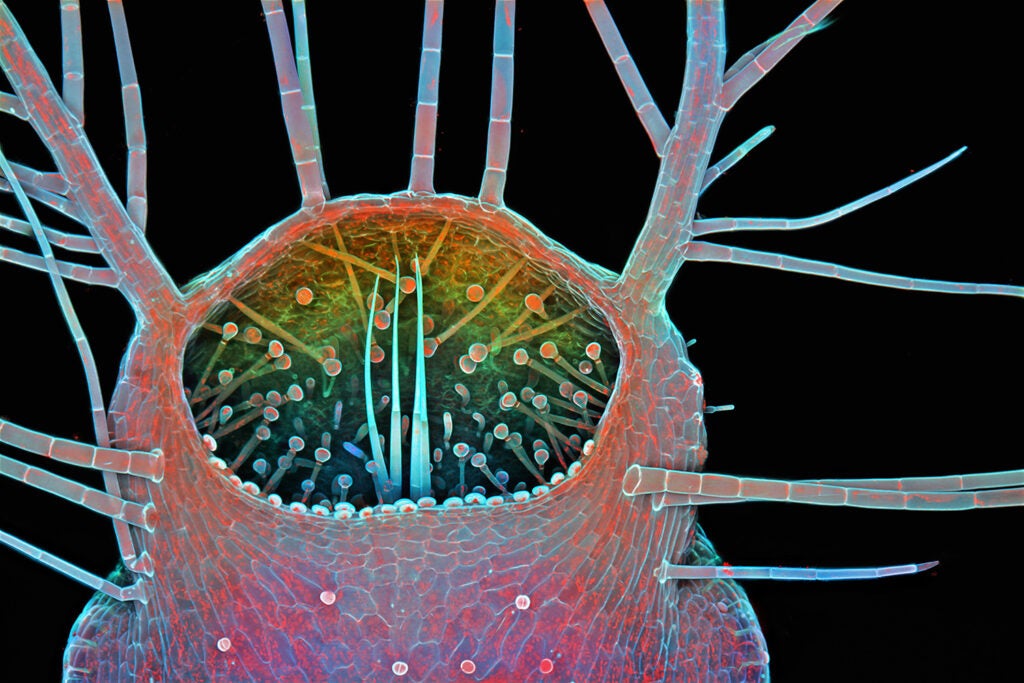 Third Place: Bladderwort