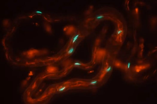 Small Sperm