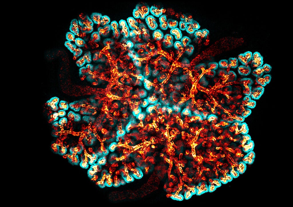 transgenic kidney cultures