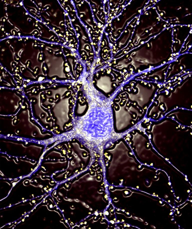 Hippocampal neuron