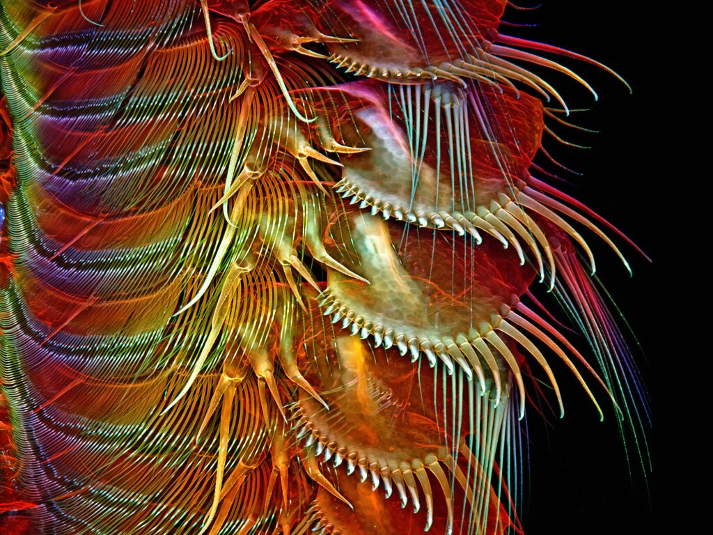 brine shrimp appendages under a microscope