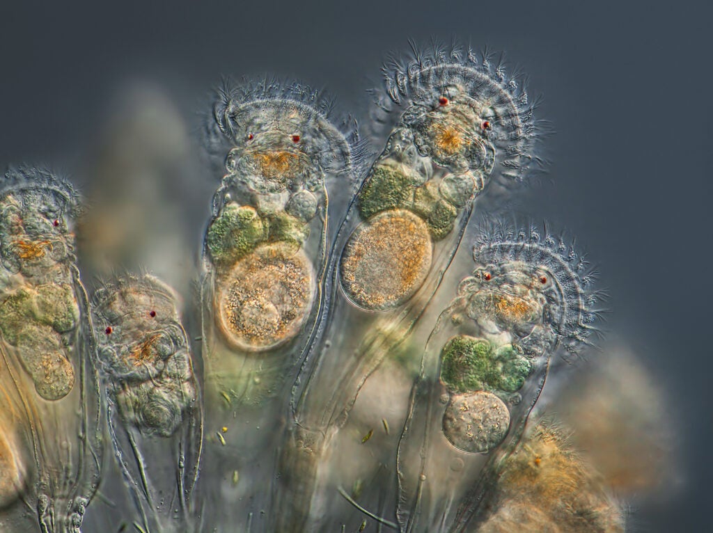 feeding Conochilus unicornis rotifers