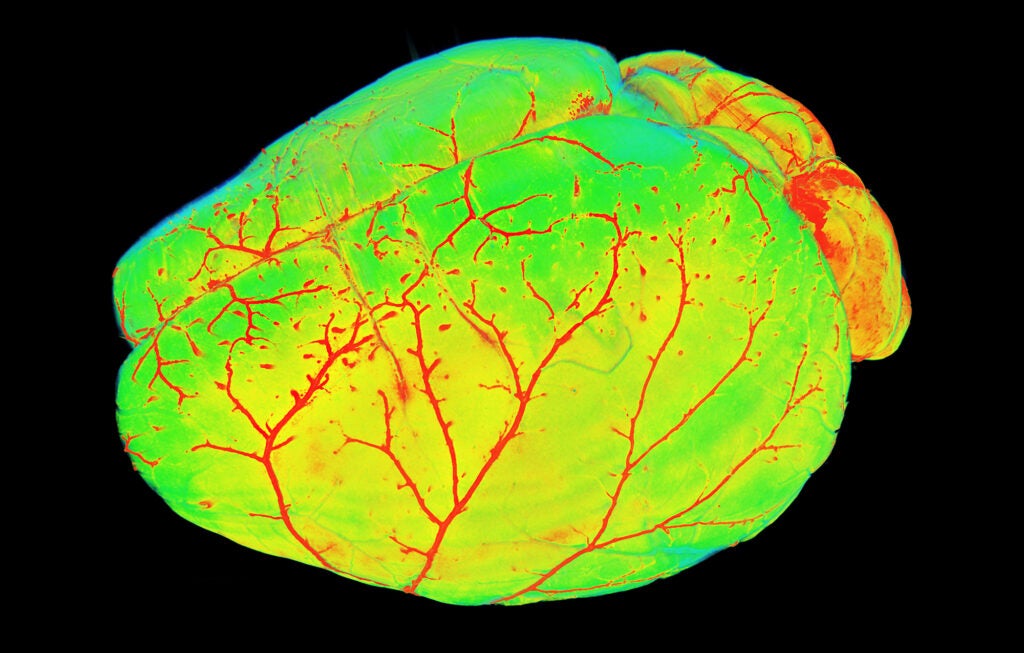 fluorescent mouse brain