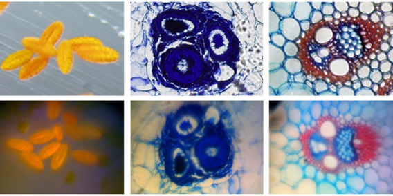 $50 Hack Turns Your iPhone Into 350x Microscope