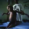 Heroes-of-Photography-Brent-Stirton-A-young-refu