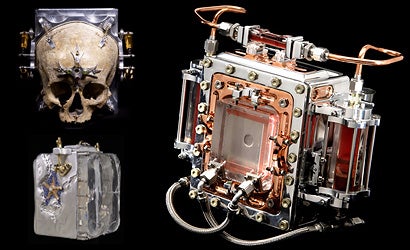 Belger-Captures-Images-Through-Skulls-Infected-Blood
