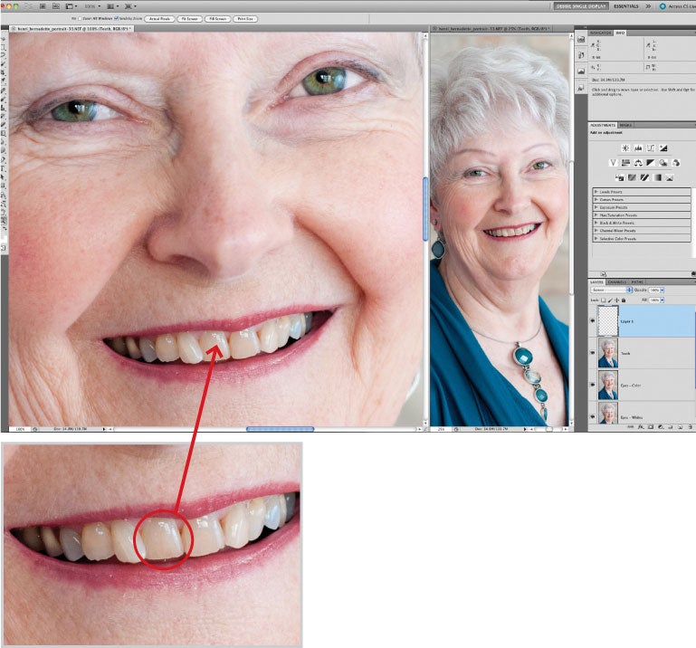 pop_retouch_teeth_2.jpg