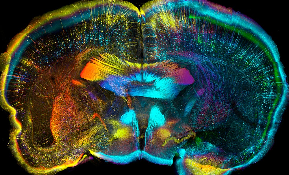 Mouse brain