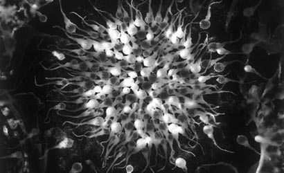 Photography-Contest-Won-Without-a-Camera