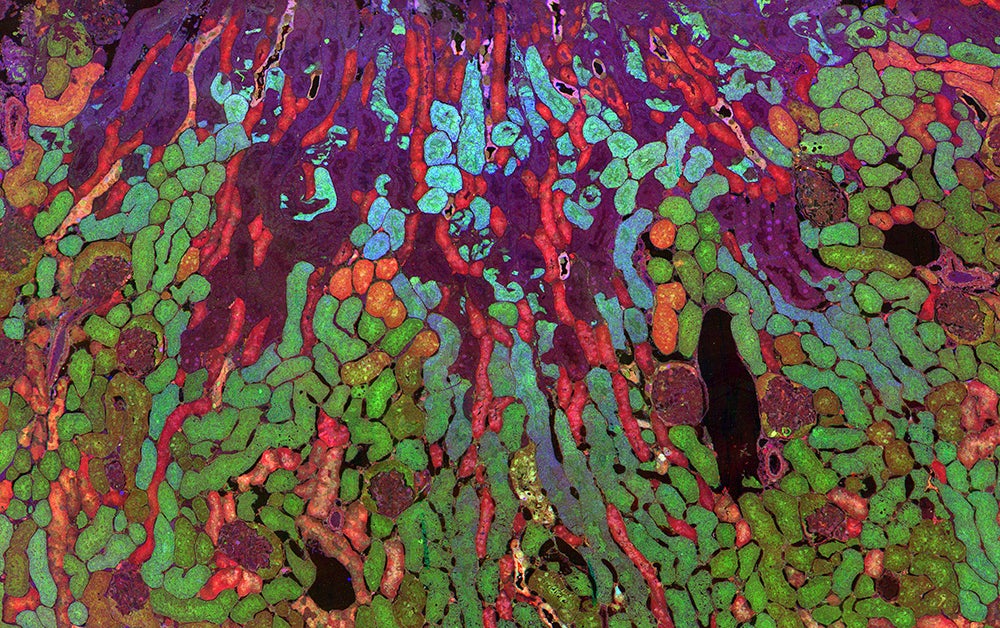 Chemical Reactions in the Kidney