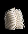 3D-printed Lungs in Ribcage