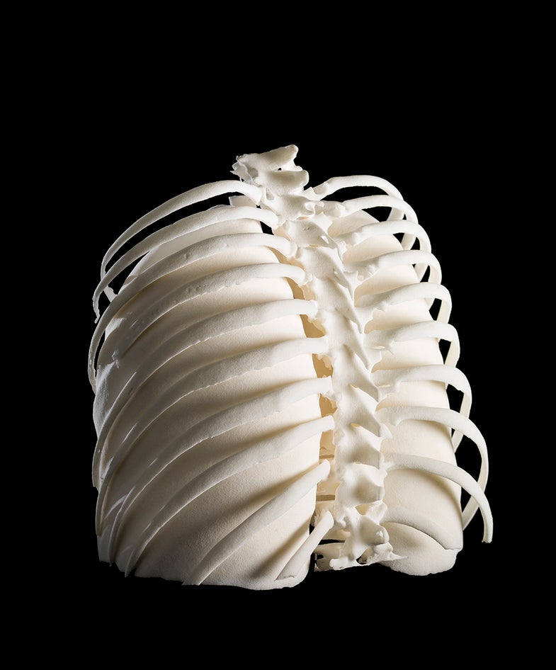 3D-printed Lungs in Ribcage