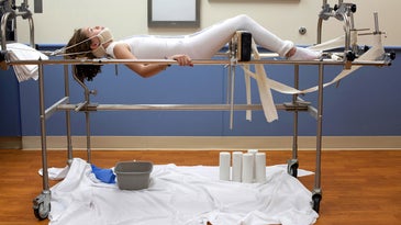 A photographer documents a pre-teen’s struggle with idiopathic scoliosis