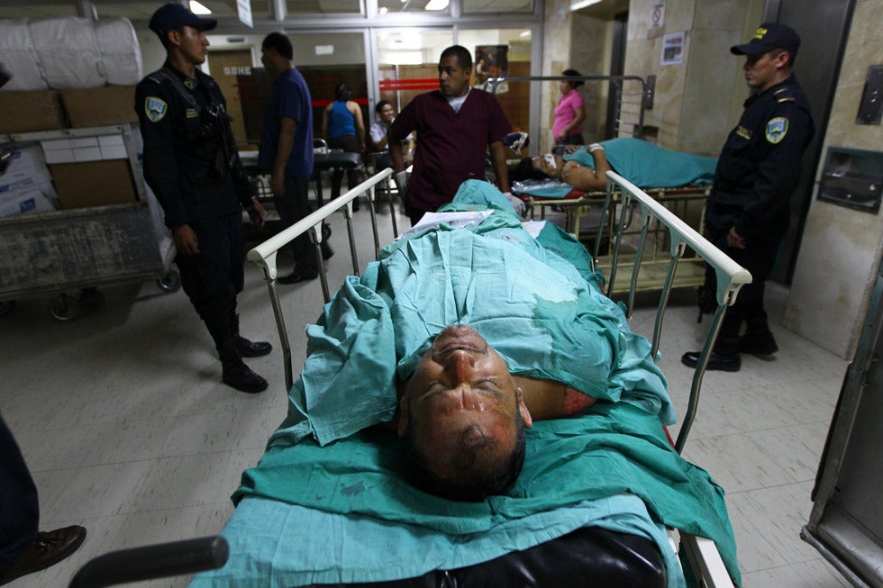 Jaime William Enriques, 54, is a survivor of a horrific prison fire that occurred in Comayagua, Honduras that killed 355 people. Sustaining burns on roughly 20% of his body, Enriques is seen here in the hospital. The prison fire is the world’s deadliest in the past decade.