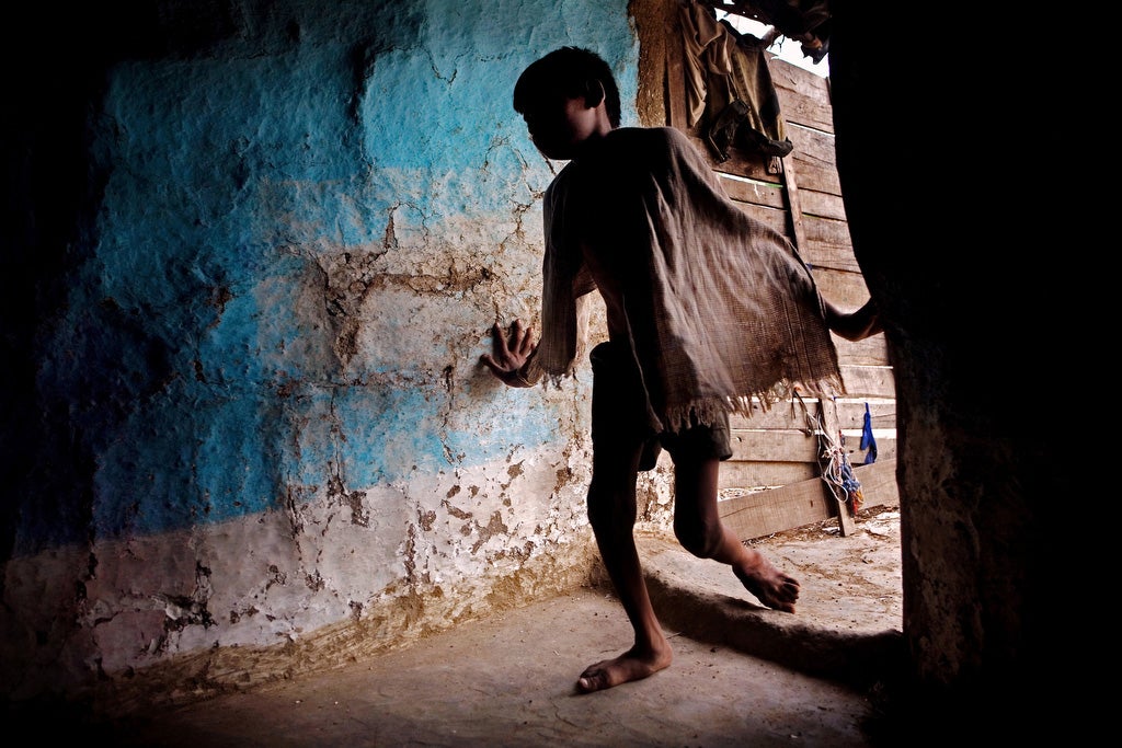 Sachin, 14, a child with a severe physical disorder affecting his bone structure and legs, is entering his home in the impoverished Oriya Basti Colony in Bhopal, Madhya Pradesh, near the abandoned Union Carbide (now DOW Chemical) industrial complex.