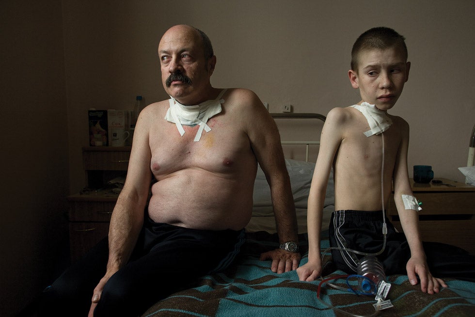 In 2005 Oleg Shapiro, 54, and Dima Bogdanovich, 13, received thyroid cancer treatment in Minsk, Belarus, where surgery is performed daily. Shapiro was exposed to extreme levels of radiation while working as a liquidator. Dima’s mother blames Chernobyl’s nuclear fallout for her son’s illness.
