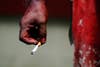 A bleeding Shi'ite Muslim man holds a cigarette as he rests after taking part in the Ashura religious festival in Yangon, Myanmar.