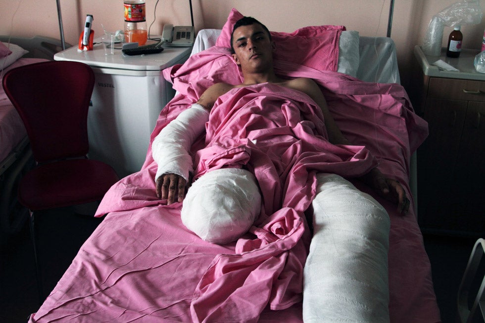 Gaia Anderson captured this portrait of Muhammed Ibrahim, an 18-year-old Syrian singer who was badly injured when a Syrian army shell exploded during an anti-Assad protest. Ibrahim is currently recovering at a hospital in Antakya, Turkey. Anderson is a freelance photographer working for the Associated Press in Turkey. You can check out one of his many photoblogs <a href="http://stainland.tumblr.com/">here</a>, <a href="http://gaiaanderson.tumblr.com/">here</a> and <a href="http://littleitalithebigfall.tumblr.com/">here</a>.
