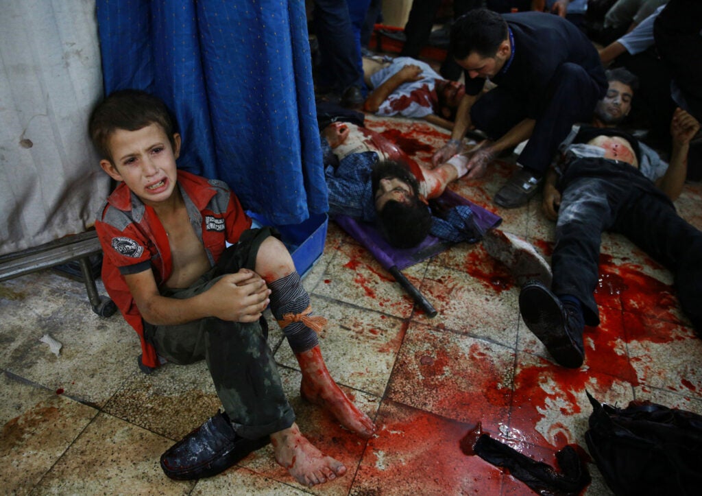 A wounded Syrian boy sits on the floor next to men receiving treatment at a make-shift hospital in the rebel-held area of Douma, east of the capital Damascus, following reported air strikes by regime forces, on August 12, 2015.