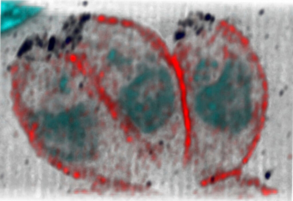 Toxoplasmosis-Causing Parasites