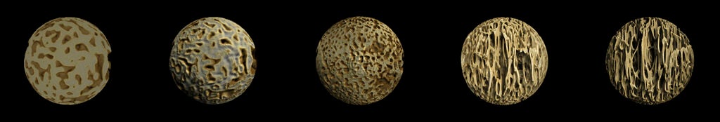 Bone Development