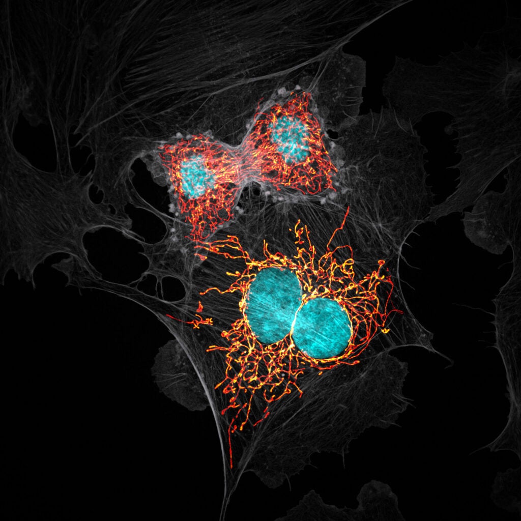 BPAE cells in telophase stage of mitosis