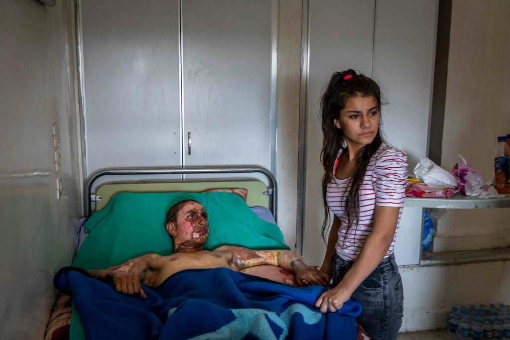 A young Kurdish SDF fighter was visited by his girlfriend for the first time, after he had been badly burnt during a battle with Turkish forces on the Syrian-Turkish border several days before. Initially she was unable to enter the room because she was so horrified by his injuries. Eventually she was coaxed into the room by a nurse and managed to hold his hand a have a short conversation.