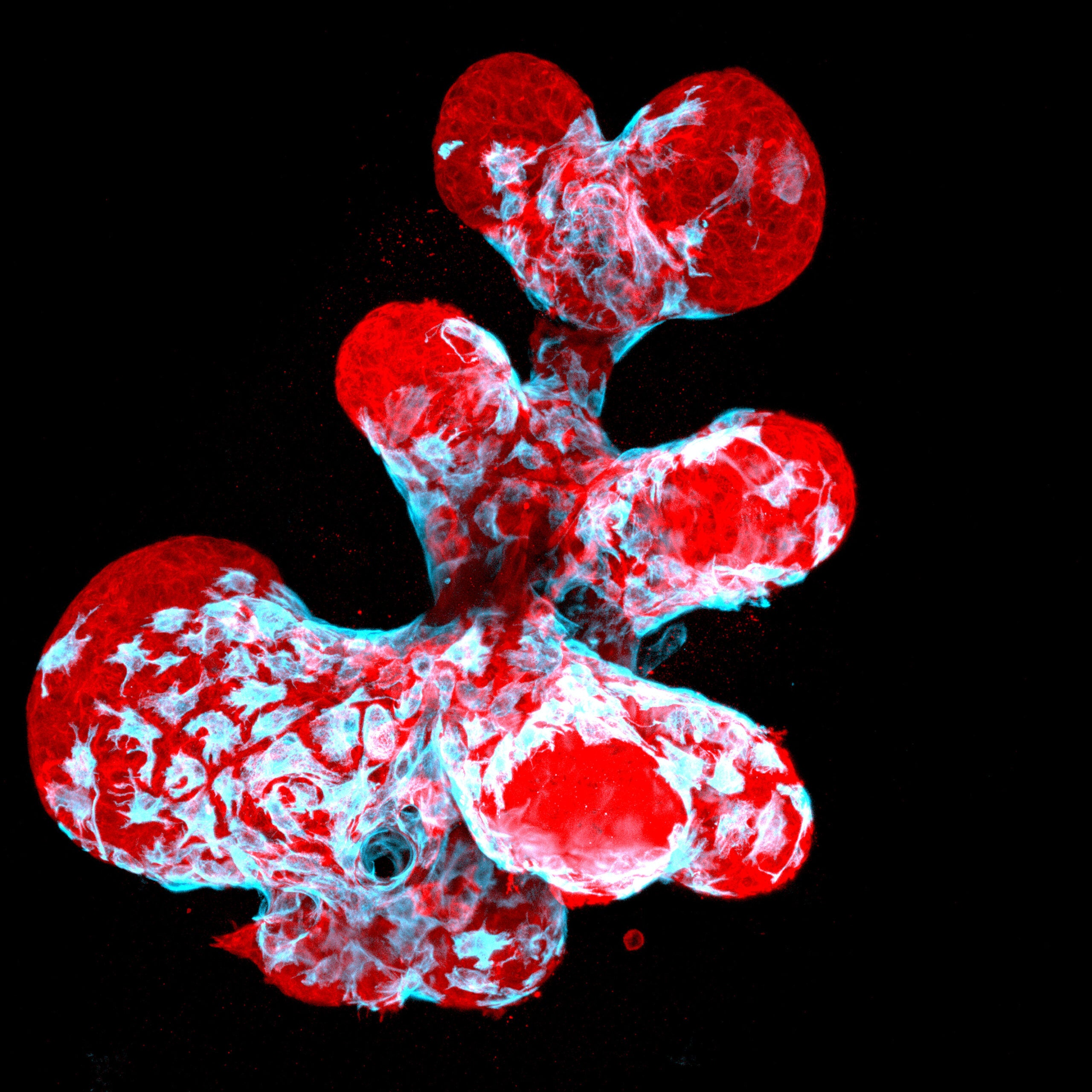 Breast organoid showing contractile myoepithelial cells (blue) crawling on secretory breast cells (red