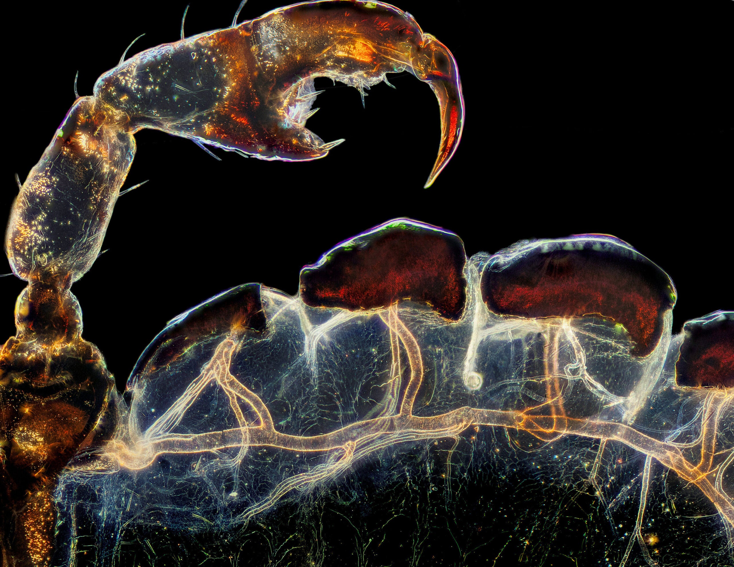 Rear leg, claw, and respiratory trachea of a louse